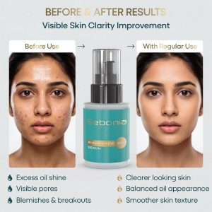 sebonia-niacinamide-zinc-serum-4