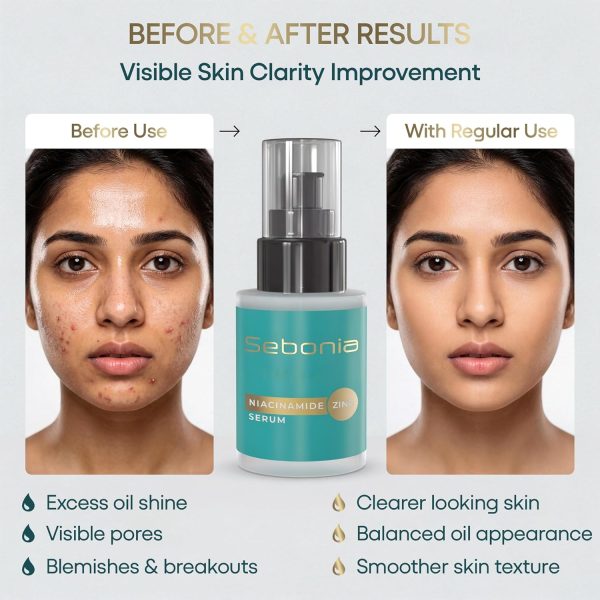sebonia-niacinamide-zinc-serum-4